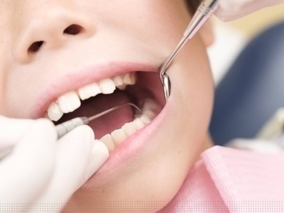 Treatment menu 04 虫歯治療